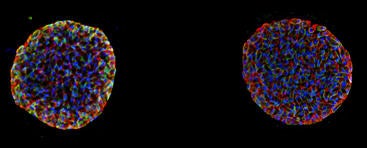 Toxoplasma gondii cysts in the transmissible form that reside inside neurons.